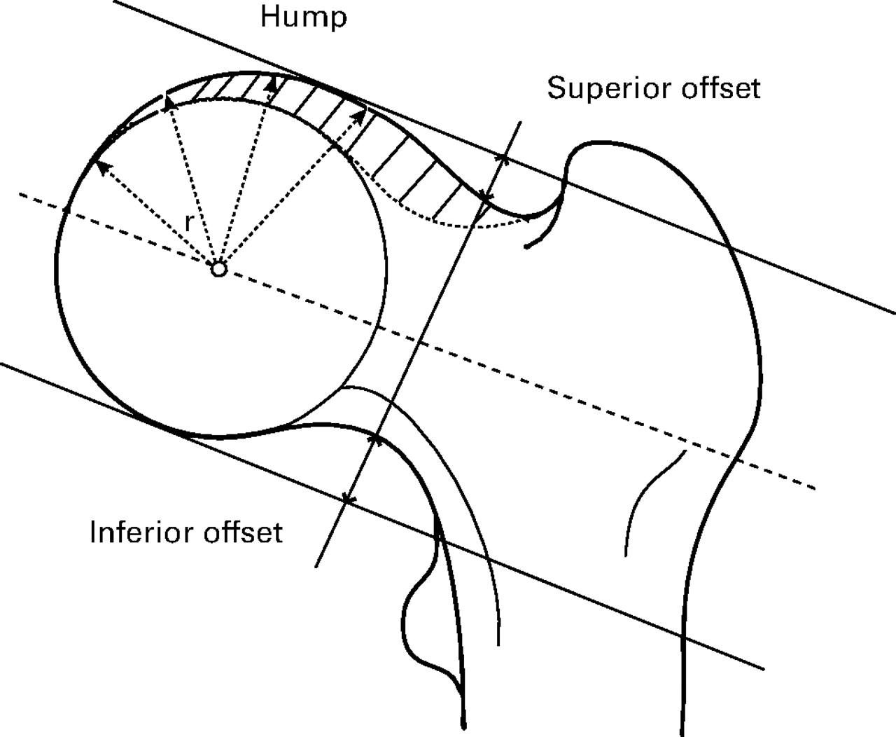 A New Radiological Index For Assessing Asphericity Of The Femoral Head