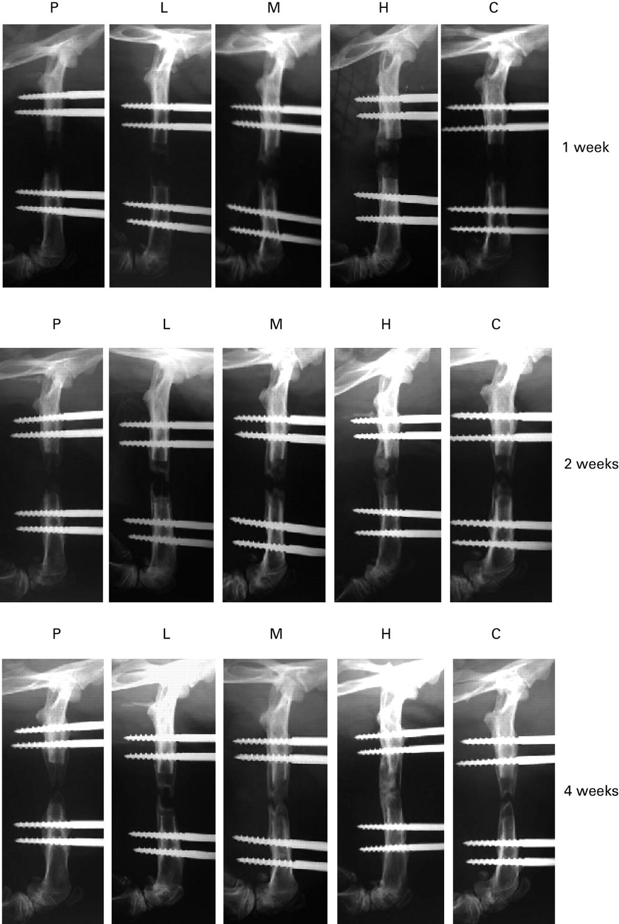 The Effect Of The Platelet Concentration In Platelet Rich Plasma Gel On