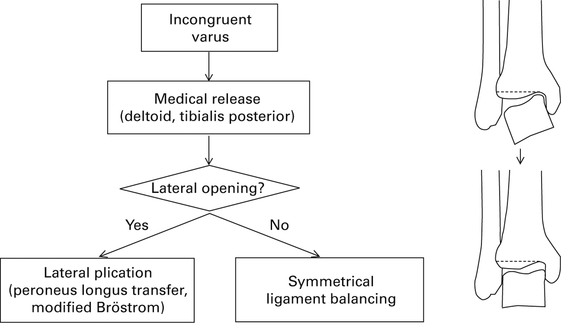 Total Ankle Replacement In Moderate To Severe Varus Deformity Of The