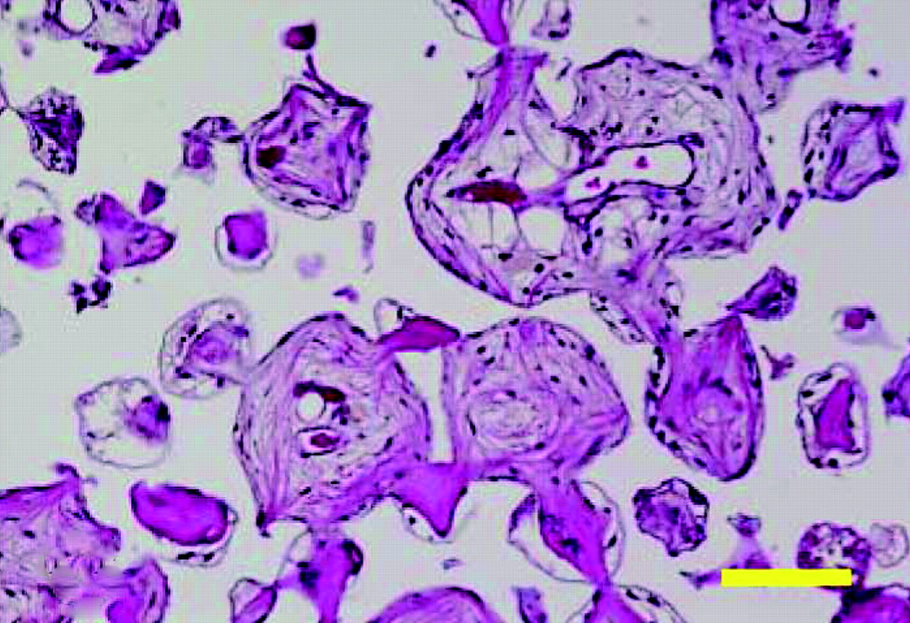 Enhancement Of Bone Formation In An Experimental Bony Defect Using