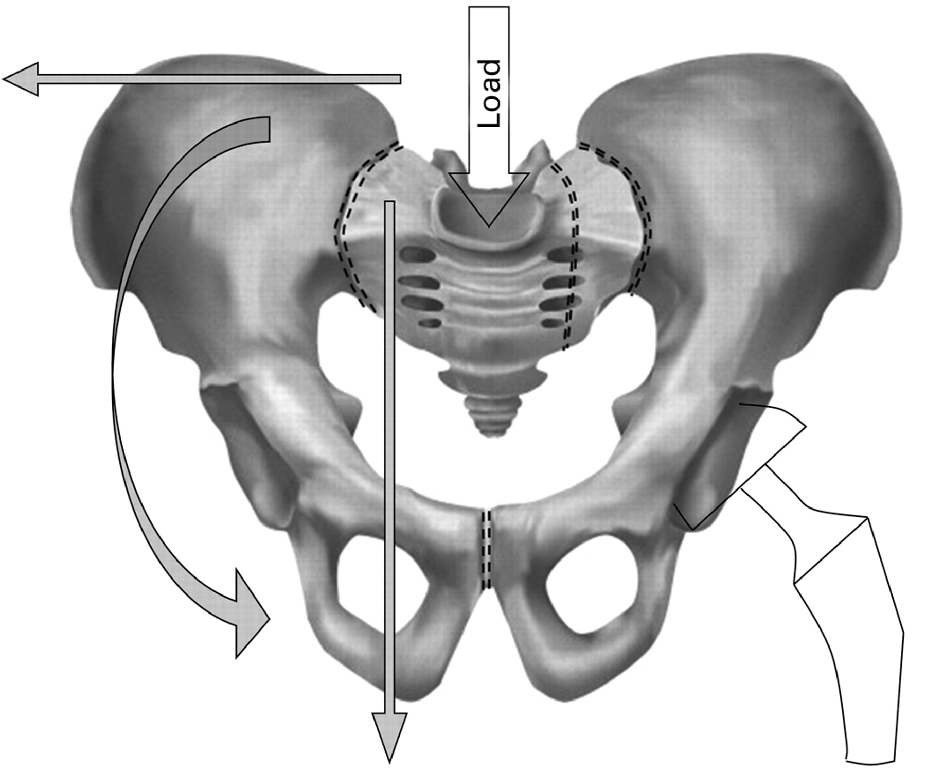 Biomechanical Testing Of A Concept Of Posterior Pelvic Reconstruction