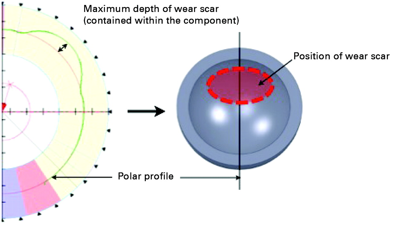 Retrieval Analysis Of 240 Metal On Metal Hip Components Comparing