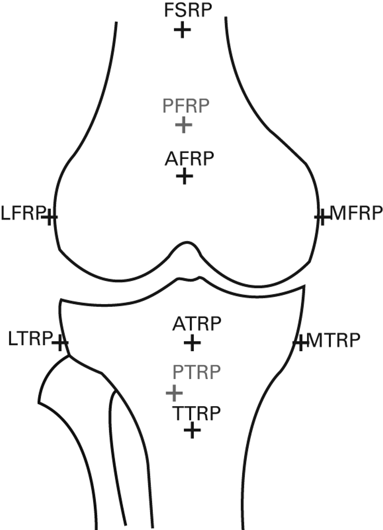 The Contribution Of Each Anterior Cruciate Ligament Bundle To The