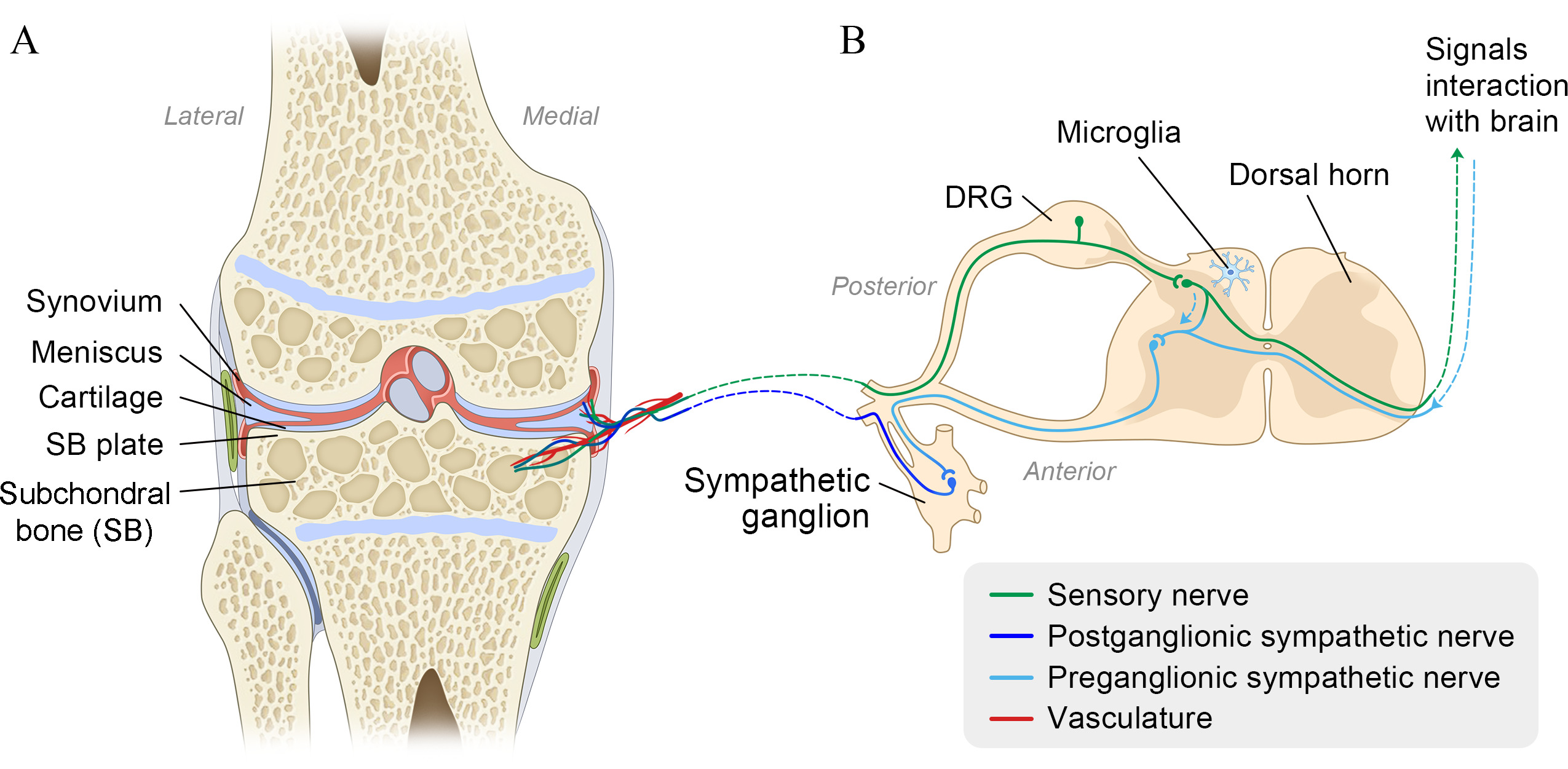 Fig. 1 
            Peripheral innervation and the route of neuron from central nervous system (CNS) to the knee joint. a) The coronal section of the knee joint; b) the cross-section of the knee-related lumbar spinal cord. The knee joint is well innervated by both sensory and sympathetic nerve fibres with fine nerve branches, including subchondral bone, synovium, and meniscus. Sensory and sympathetic nerves mediate the signals between the joint and CNS after relay in the spinal cord. The sensory nerve has a pseudo-unipolar morphology. The axon derived from dorsal root ganglion (DRG) split into the central branch (forms a synaptic junction with second-order sensory neurones in the dorsal horn to relay the information to CNS) and peripheral branch (extends the target cells or tissues of the joint). After relay in the lateral horn of spinal cord, preganglionic neurone communicates with postganglionic neurone through chemical synapses within the sympathetic ganglion; postganglionic neurone innervated into peripheral target tissues in the joint, commonly accompanied by vasculature (red). Additionally, the sensory nerve can interact with sympathetic nerve at the level of spinal cord.
          