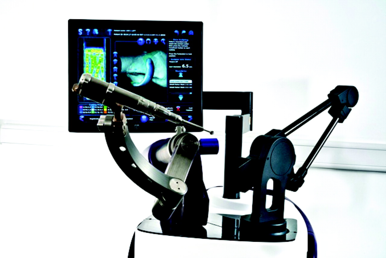 Fig. 1 
          The Stanmore Sculptor Robotic Guidance Arm, which assists with bone preparation for the implantation of patient-specific implants.
        