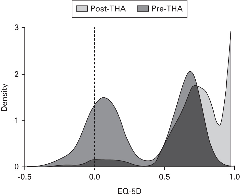Fig. 1 
            Frequency density graph of preoperative EuroQol five-dimension (EQ-5D) index in patients awaiting total hip arthroplasty (THA) and at one year following THA.
          
