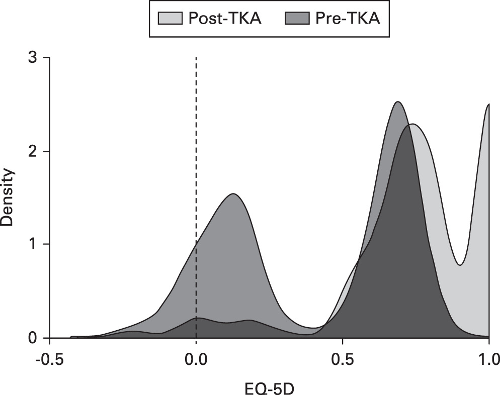 Fig. 4 
            Frequency density graph of preoperative EuroQol five-dimension (EQ-5D) index in patients awaiting total knee arthroplasty (TKA) and at one year following TKA.
          