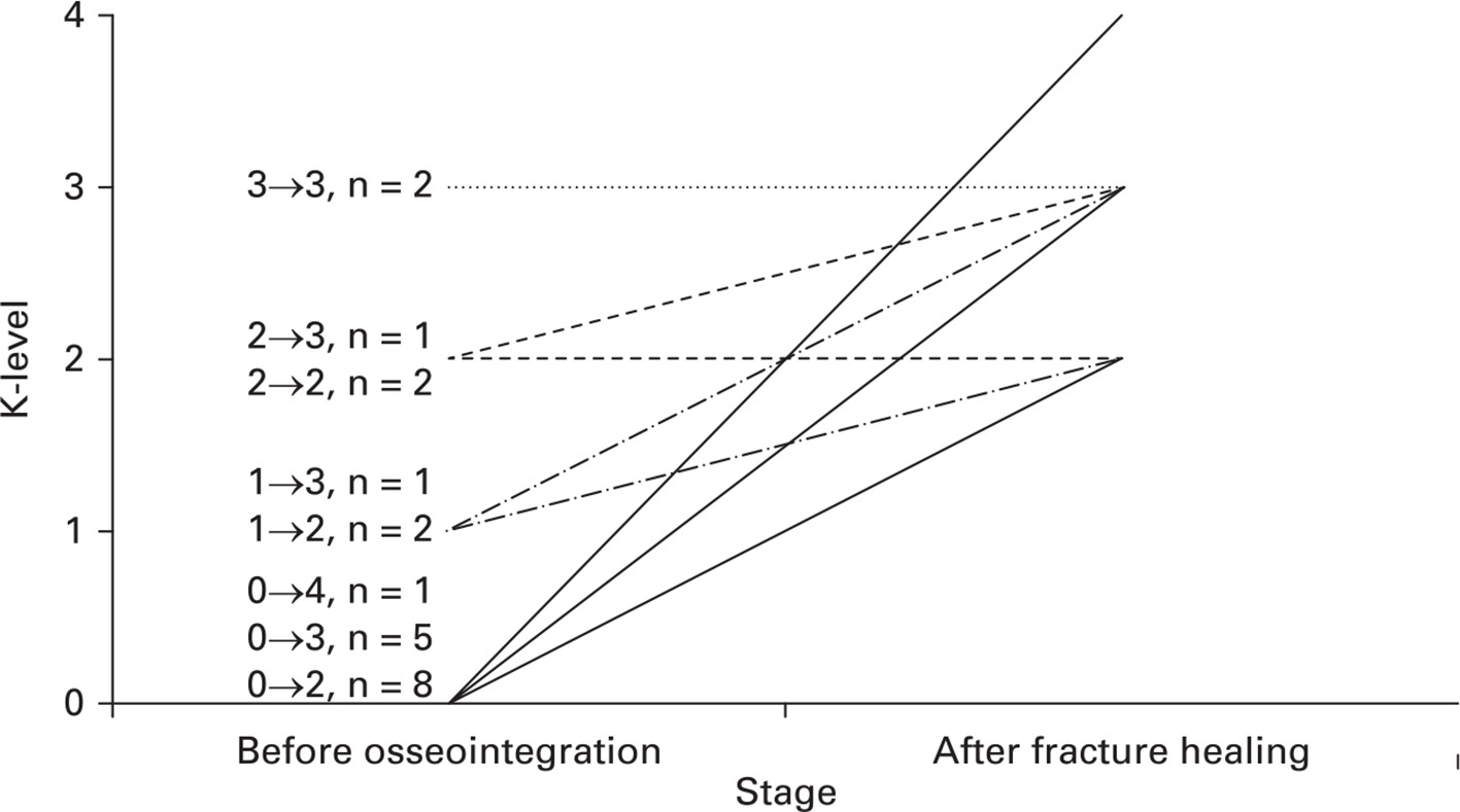 Fig. 2 
          The mobility (K-level) of patients who sustained a periprosthetic osseointegration fracture is shown before osseointegration and after the care of their fracture was complete. Numerical labels represent pre-osseointegration K-level → current post-fracture K-level, number of patients in this grouping. Notable points: 1) The K-level declined in no patients; 2) all maintained or progressed to a K-level of ≥ 2 (a community ambulator able to traverse curbs and some stairs); 3) even those who were originally confined to a wheelchair (K-level 0) before osseointegration improved to and maintained a K-level of ≥ 2 despite sustaining a fracture.
        