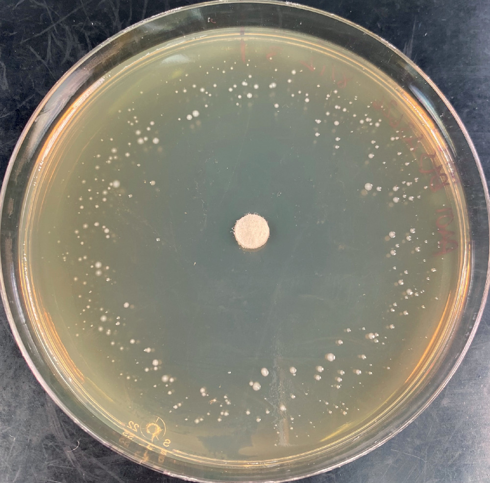Fig. 2 
            Photograph demonstrating the appearance of phoenix colony variants of Pseudomonas aeruginosa in a biofilm lawn plate at four days. In the centre is a disc containing tobramycin, which has created an antibiotic gradient radiating from the centre of the plate. The clear zone in the central region is where the antibiotic gradient has killed all biofilm bacteria, including resistant and variant phenotypes. At the rim of the plate is the remains of the wild-type lawn (diffuse light tan hue) where the antibiotic gradient remains below the minimum inhibitory concentration. In between the peripheral lawn and the cleared area are small, white, pinpoint “phoenix” colonies of Pseudomonas that have slowly emerged within from what first appeared to be the completely killed biofilm lawn (clear zone).
          