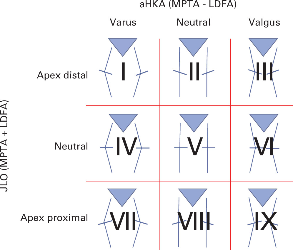 Fig. 1 
          Diagram of the Coronal Plane Alignment of the Knee classification, developed by MacDessi et al.14 aHKA, arithmetic hip-knee-ankle angle; JLO, joint line obliquity; LDFA, lateral distal femoral angle; MPTA, medial proximal tibial angle.
        