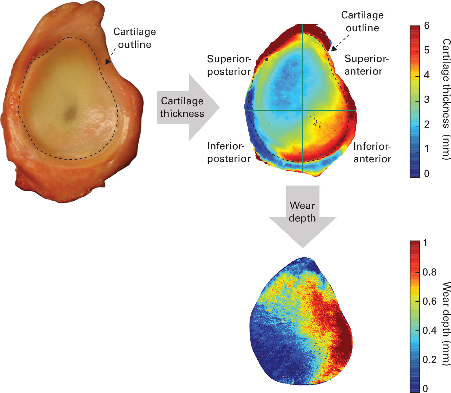 Fig. 4 
            Distribution of the thickness and wear depth of the glenoid cartilage.
          