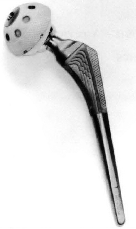 Fig. 1 
          Omnifit HA stem (Osteonics, USA).
        