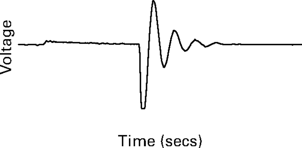 Fig. 1a, Fig. 1b, Fig. 1c  
            Diagrams of the waveform of the non-invasive neurostimulation device showing a) no skin contact, b) high-impedance skin contact, and c) low-impedance skin contact. The waveform dynamically adjusts in relation to changes in the skin. This allows localisation of sites of low impedance which are then specifically targeted. Conductive gel is not required.
          