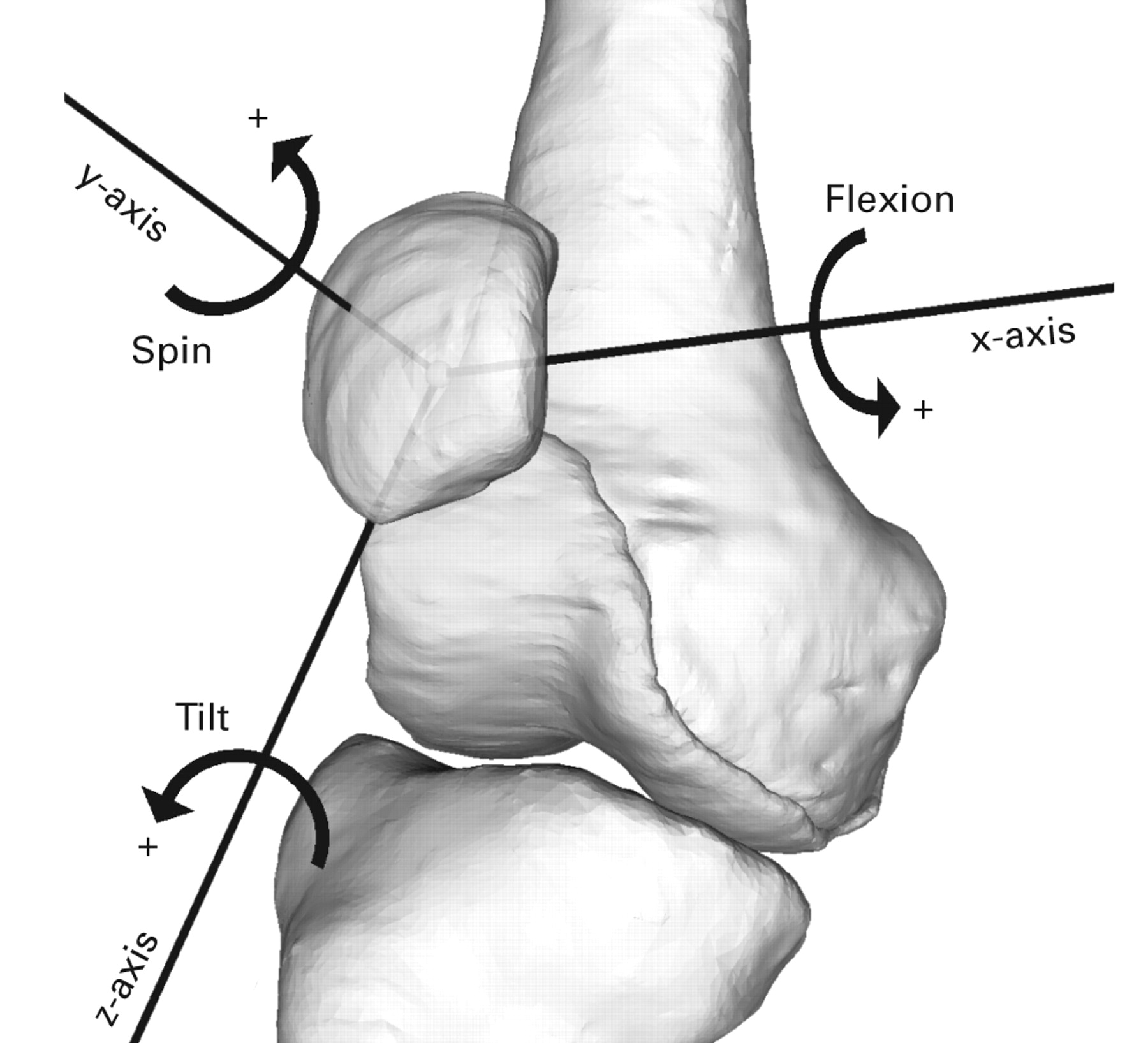 In vivo movement analysis of the patella using a three-dimensional ...