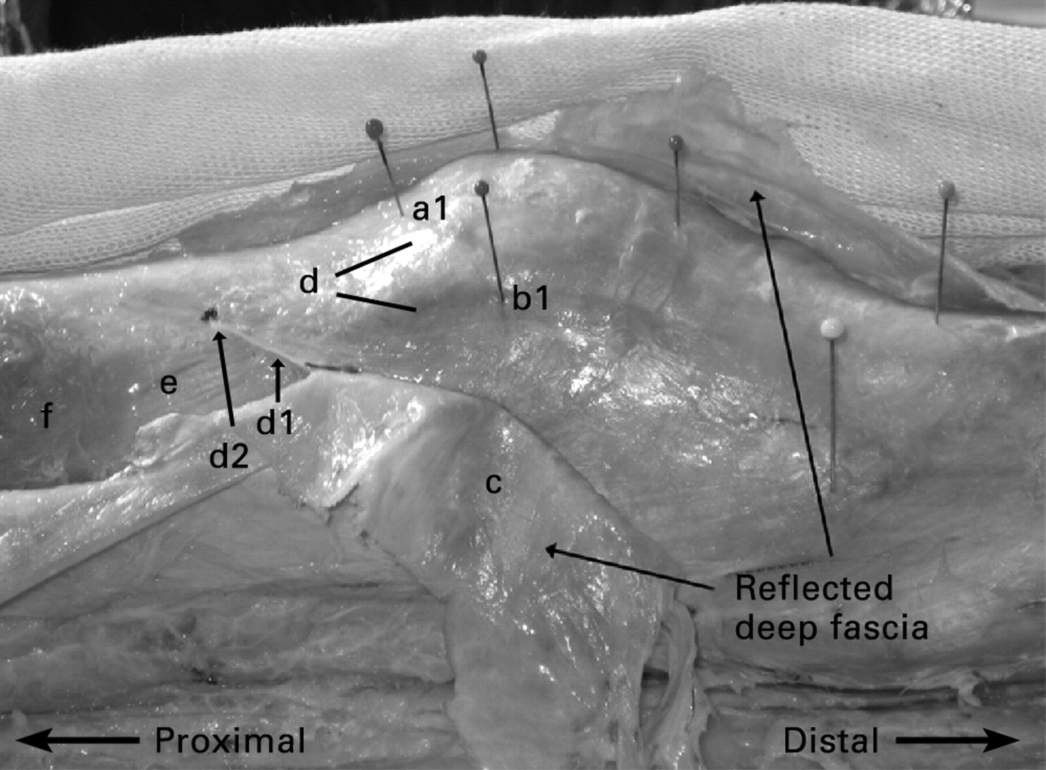 Anatomy Of The Lateral Retinaculum Of The Knee Bone And Joint 4616