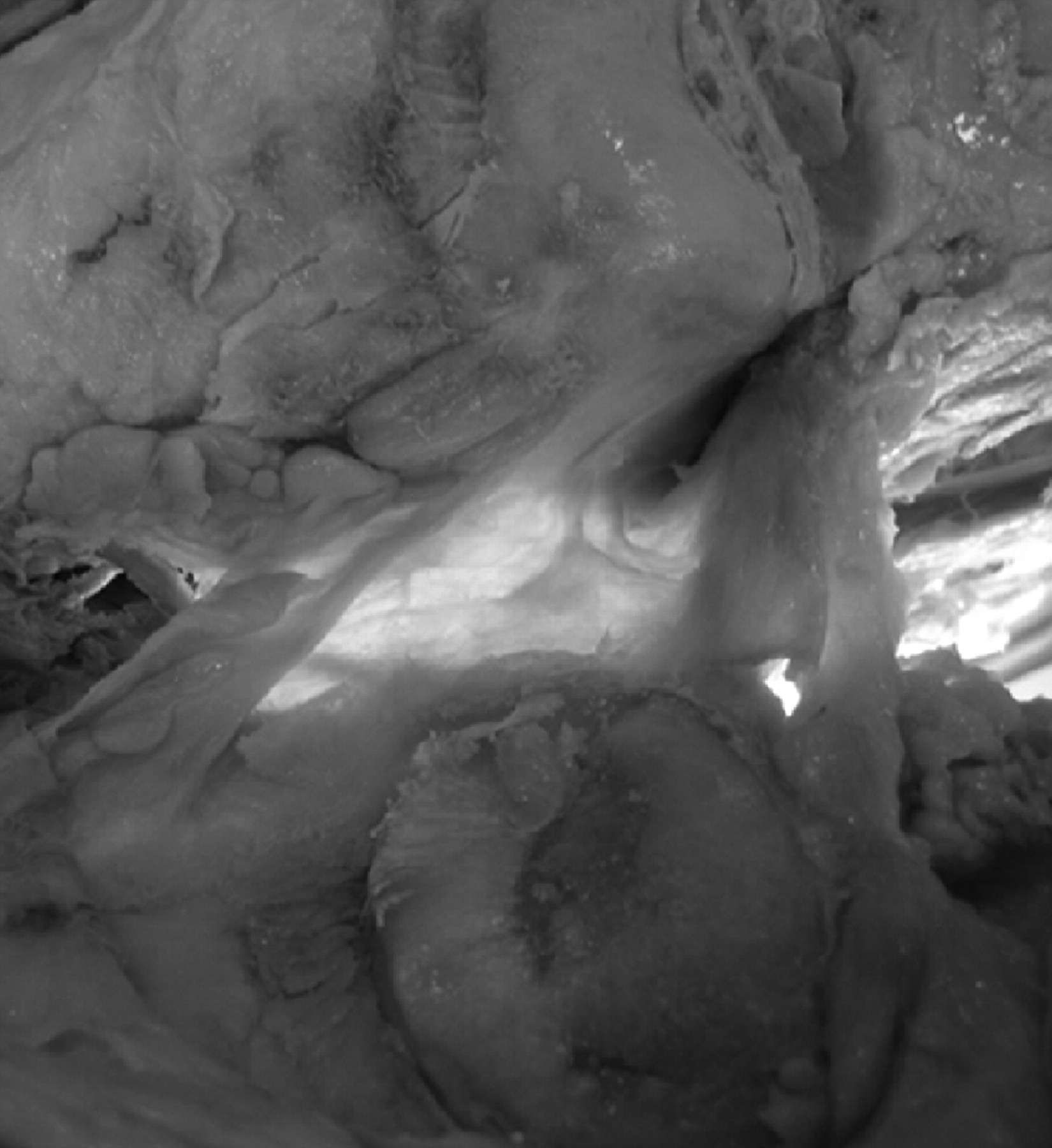 Anatomy Of The Lateral Retinaculum Of The Knee | Bone & Joint