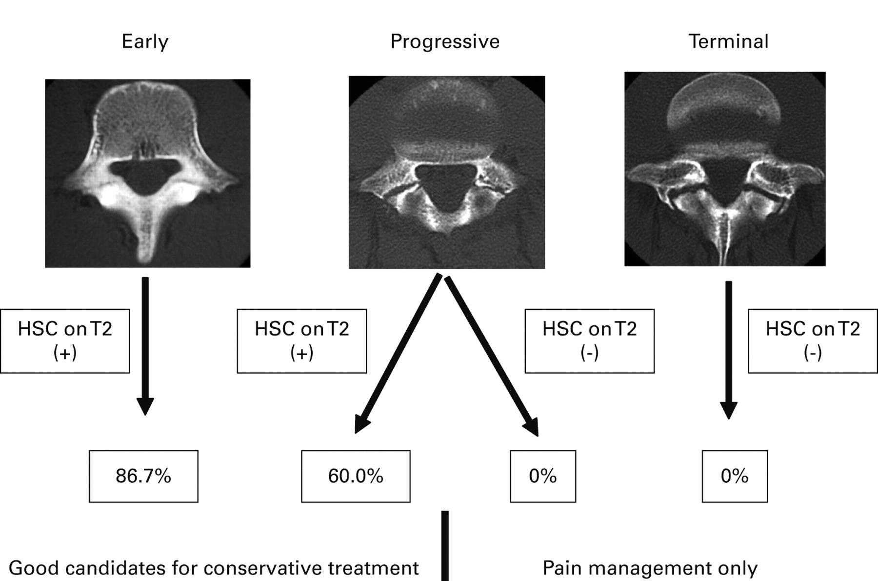 Conservative Treatment Of Lumbar Spondylolysis In Childhood And ...