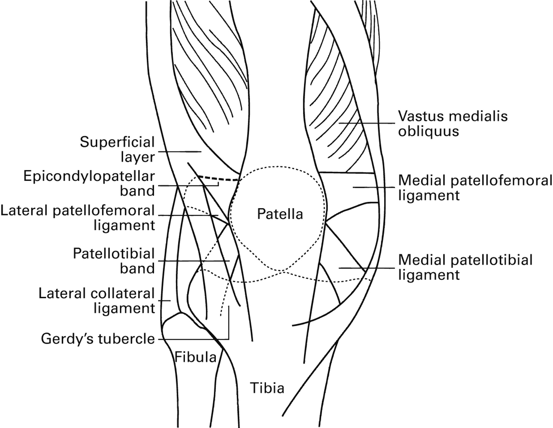 What is the role of lateral retinacular release? | Bone & Joint