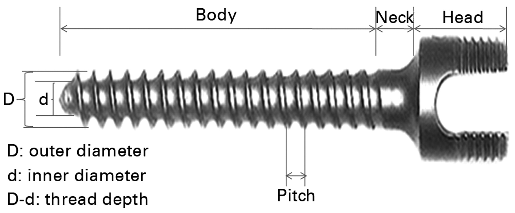 The biomechanics of pedicle screwbased instrumentation Bone & Joint