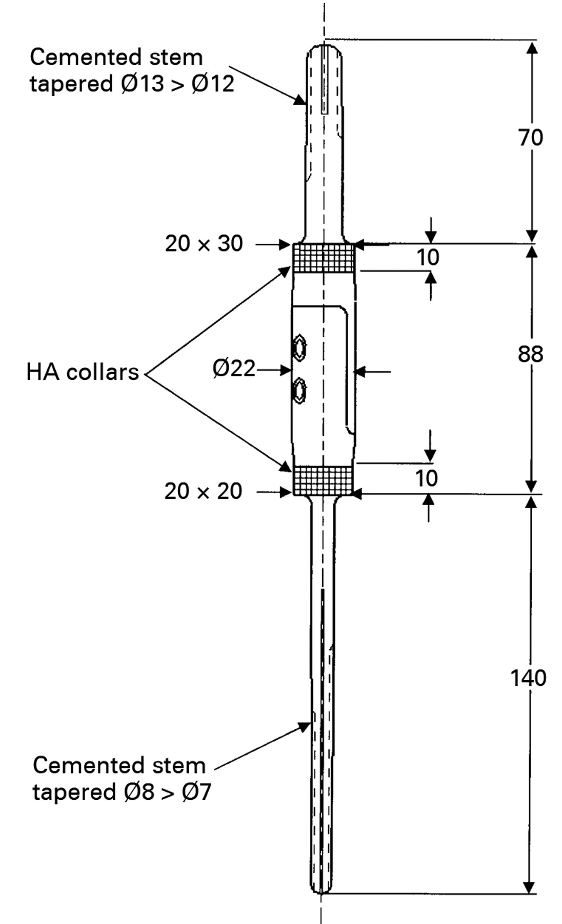 Intercalary diaphyseal endoprosthetic reconstruction for malignant ...