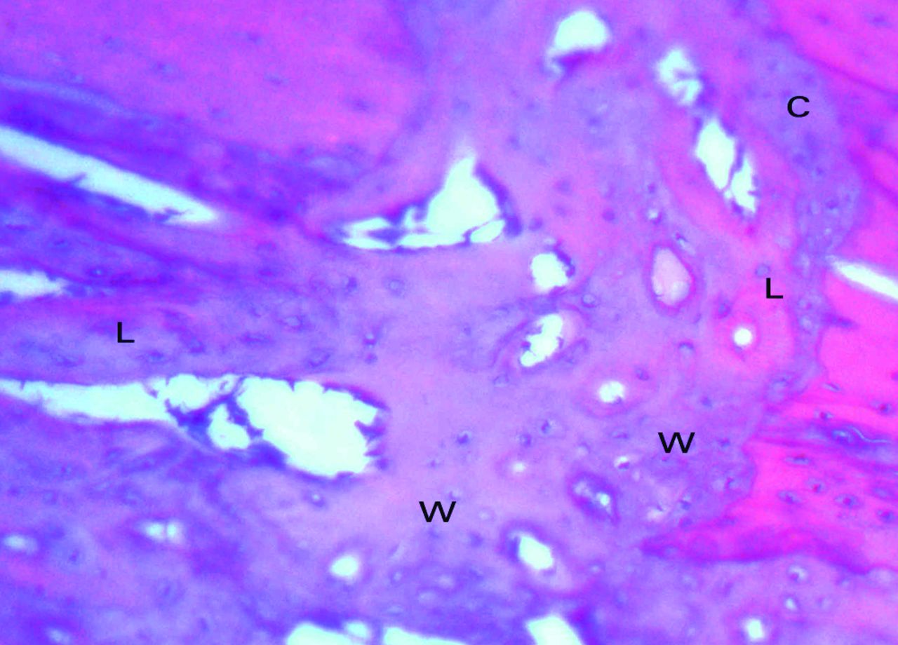 The role of the sensory nerve response in ultrasound accelerated ...