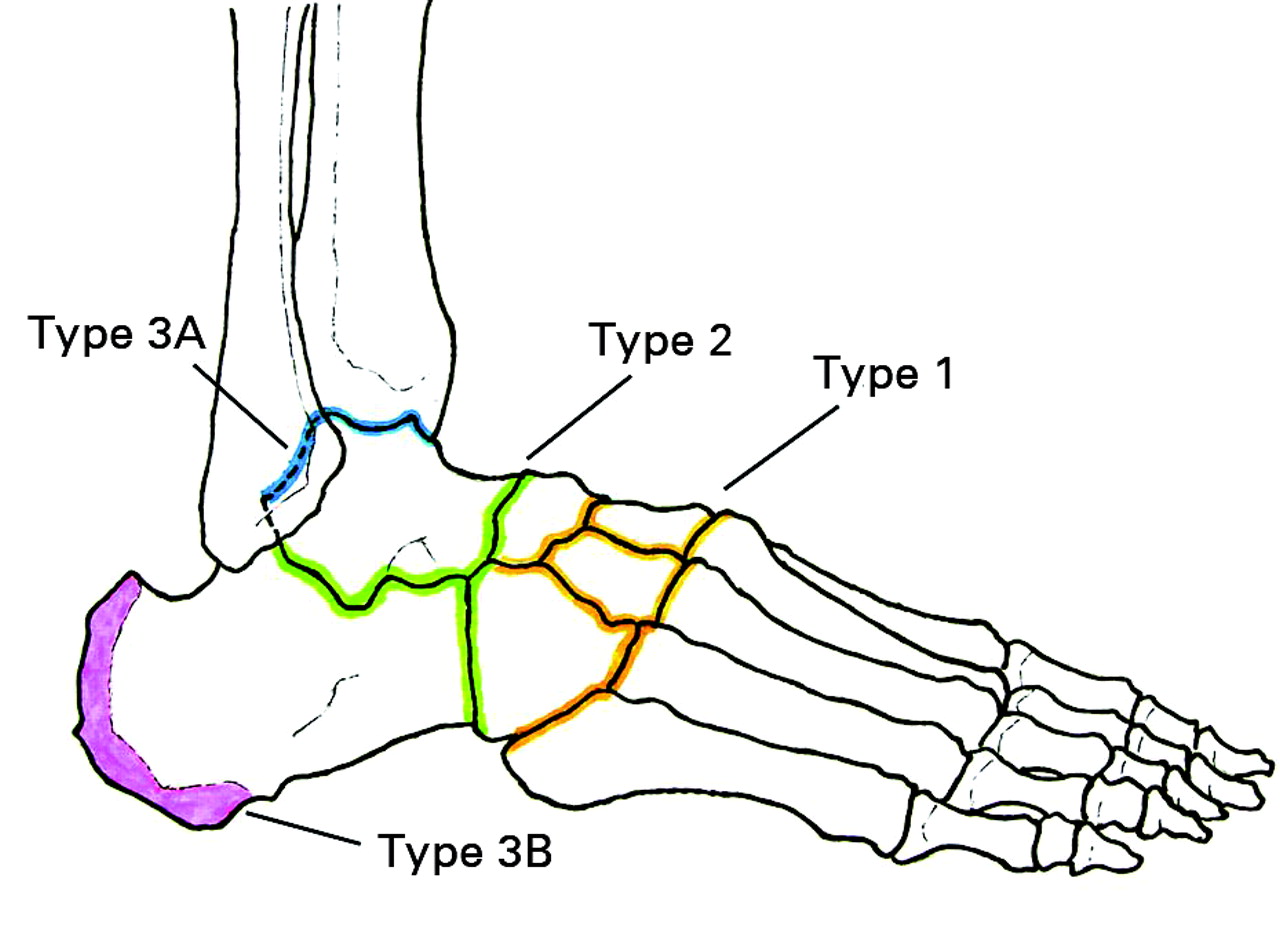 Doppler spectrum analysis | Bone & Joint