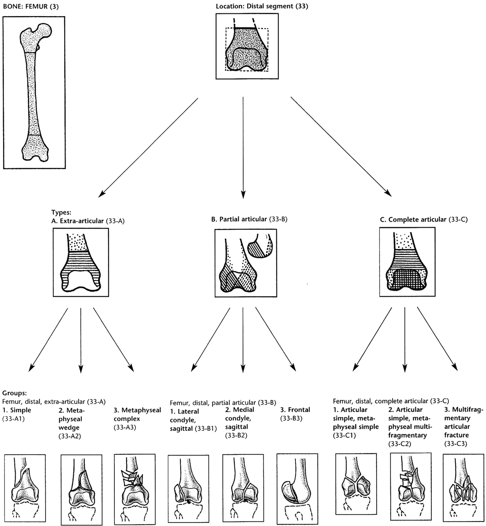 The Operative Management Of Osteoporotic Fractures Of The Knee | Bone ...