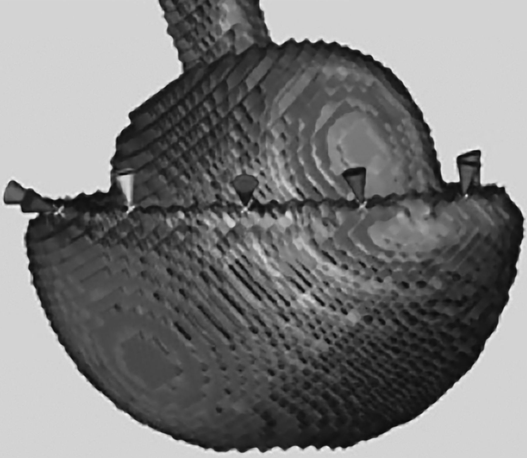 Functional Acetabular Component Position With Supine Total Hip Replacement Bone And Joint 0203