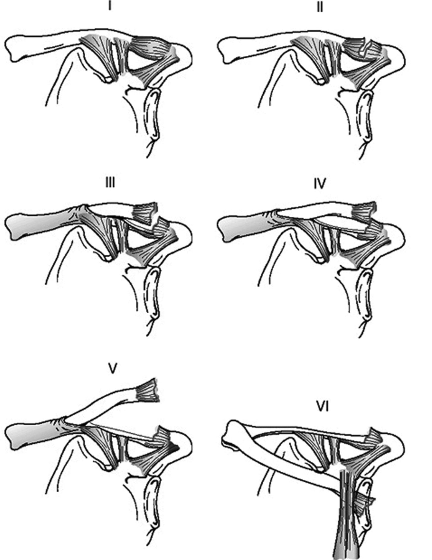 Surgical treatment of physeal injuries of the lateral aspect of the ...