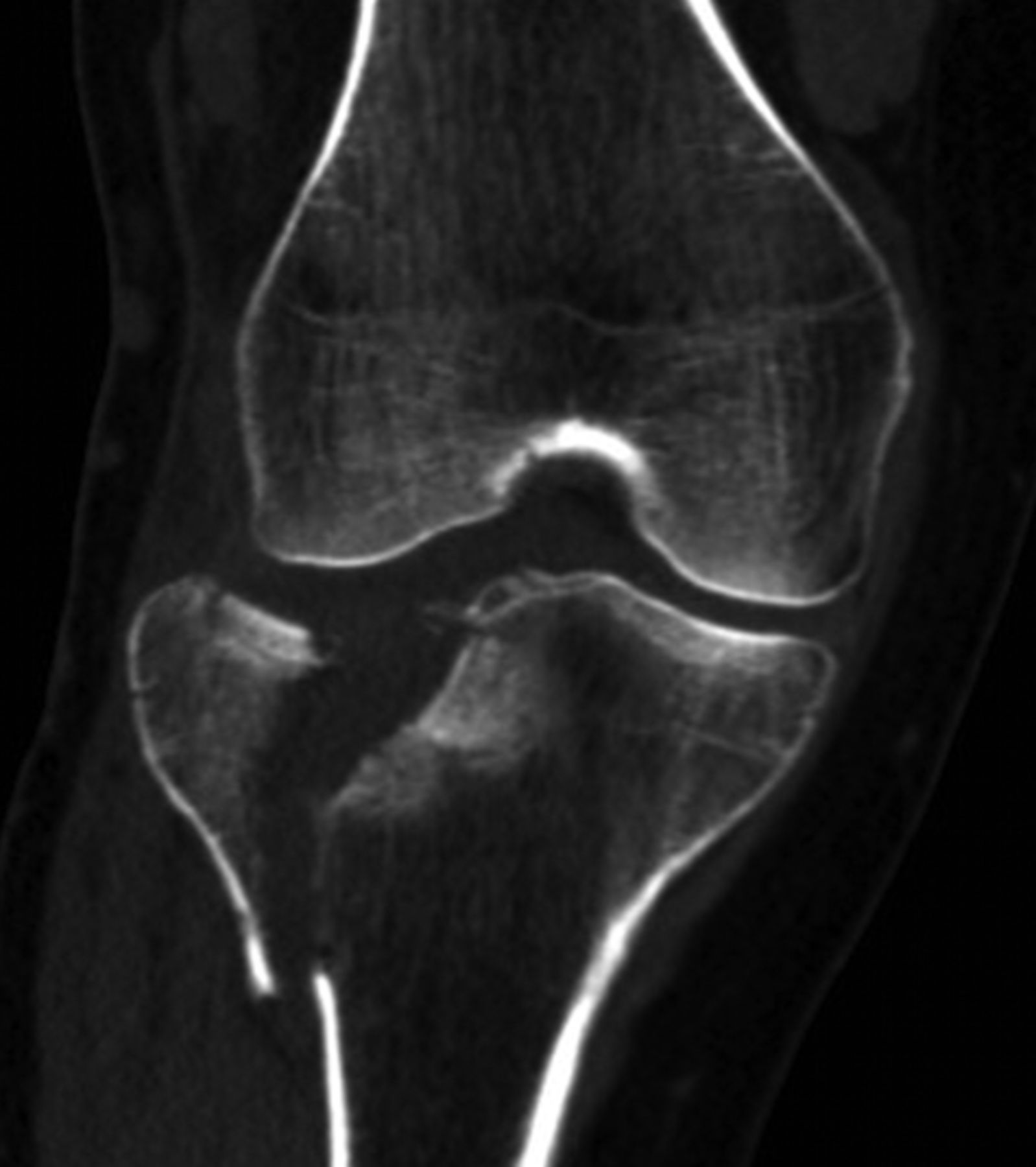 The Usefulness Of Mri And Arthroscopy In The Diagnosis And Treatment Of Soft Tissue Injuries 1050