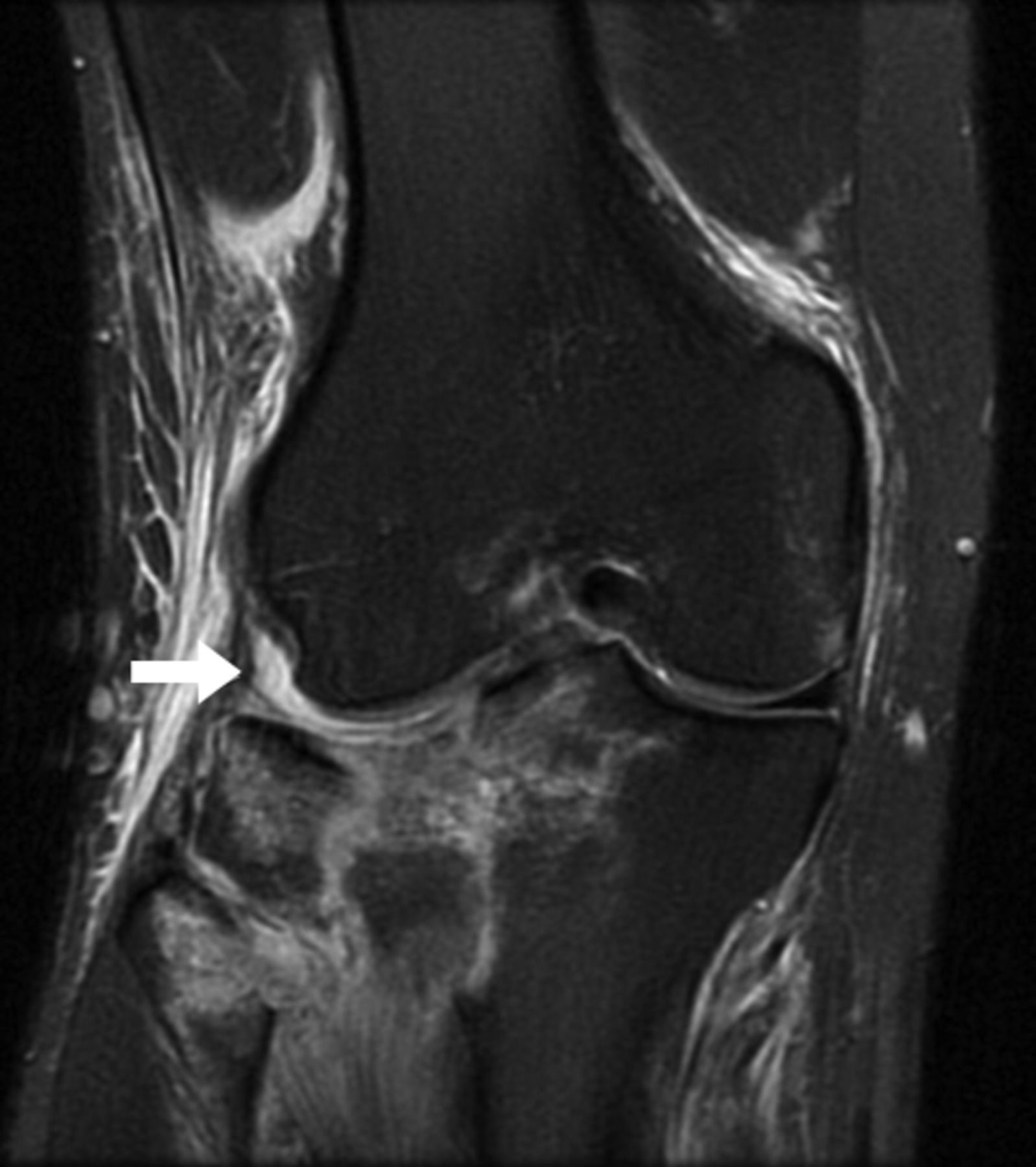 The usefulness of MRI and arthroscopy in the diagnosis and treatment of ...