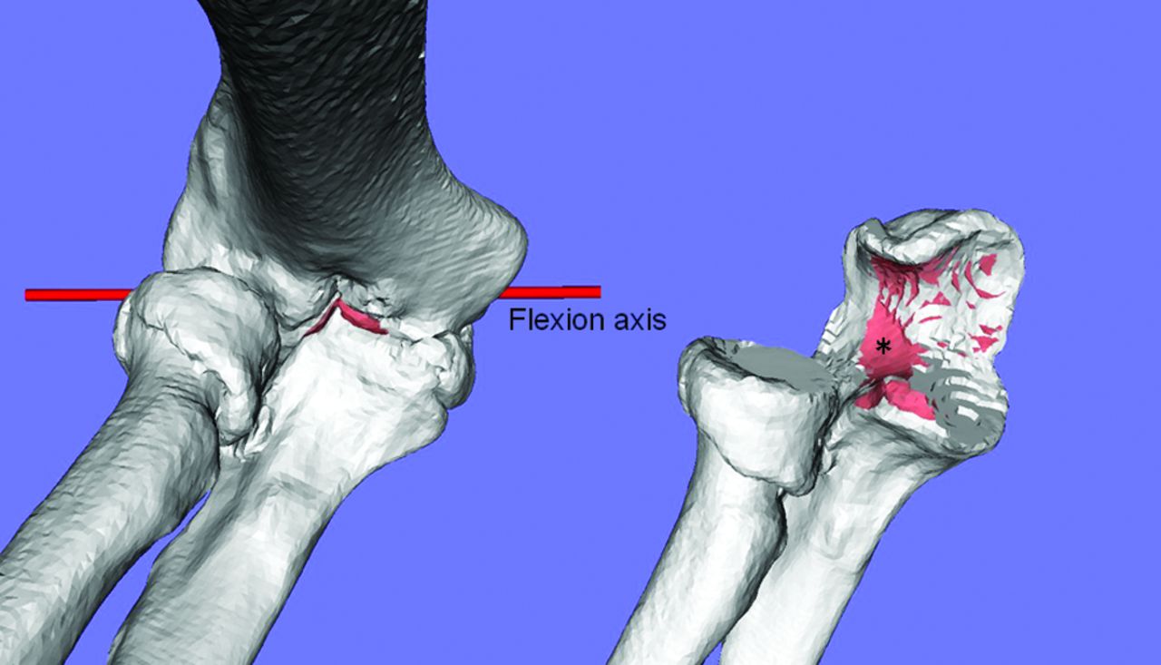 Arthroscopic Debridement In The Treatment Of Patients With ...