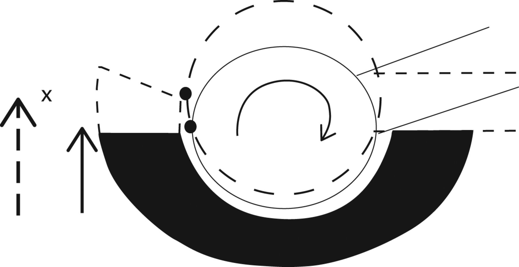 The use of a lipped acetabular liner decreases the rate of revision for ...