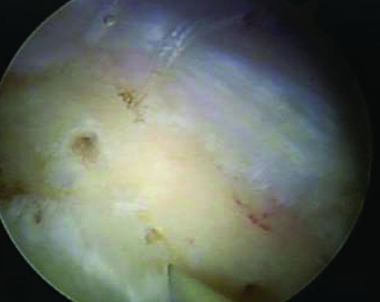 Arthroscopy of the hip for patients with mild to moderate developmental ...