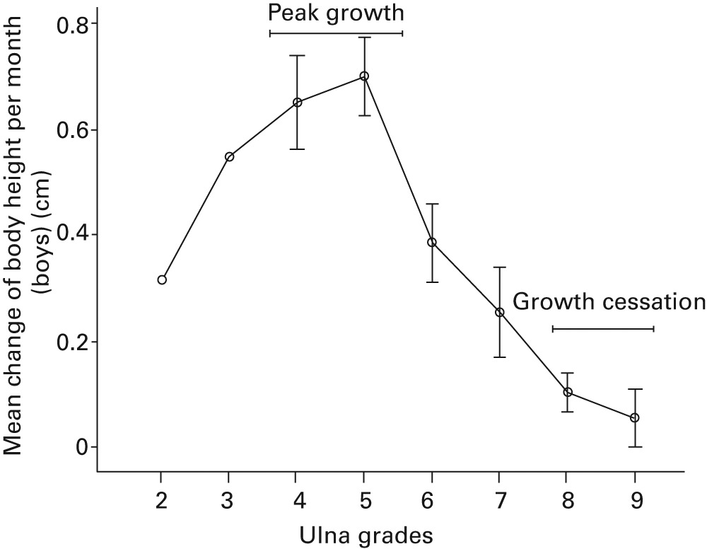 The Use Of The Distal Radius And Ulna Classification For The Prediction ...