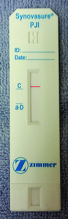 Qualitative α-defensin test (Synovasure) for the diagnosis of ...