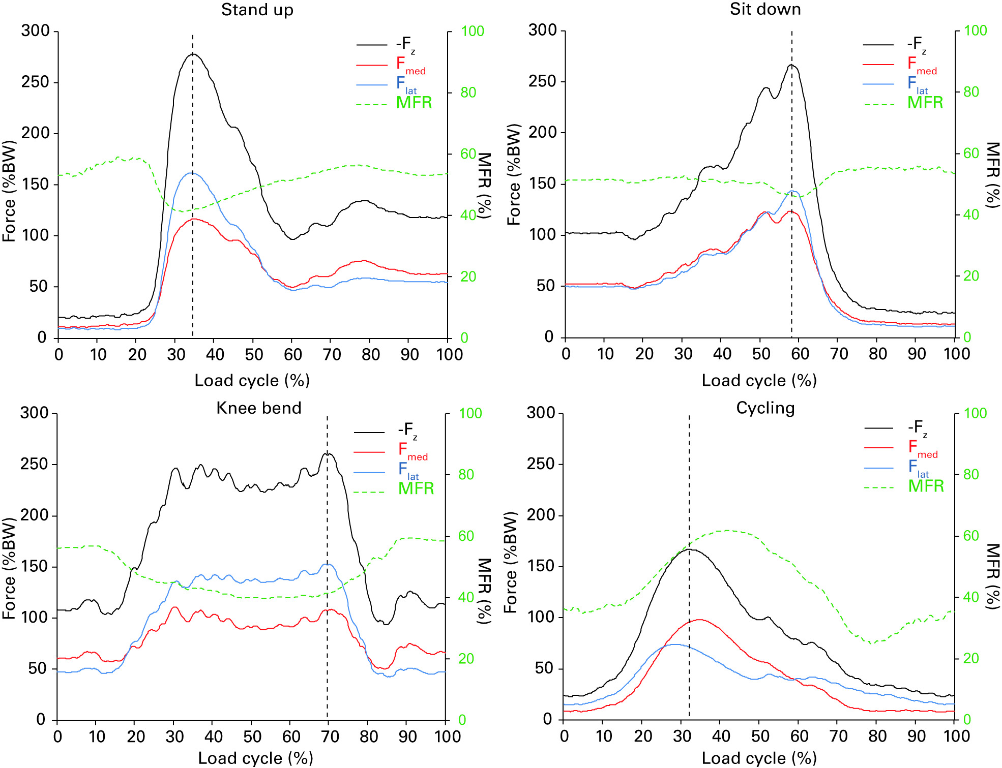 Mediolateral force distribution at the knee joint shifts across ...