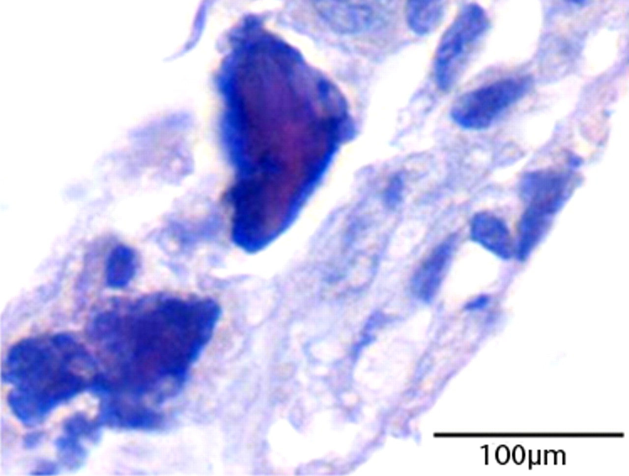 Fig. 2 
          Micrograph of the generated tissue after
three days of culture of the generated tissue. Areas of bone matrix-like
material are evident (haematoxylin and eosin staining).
        