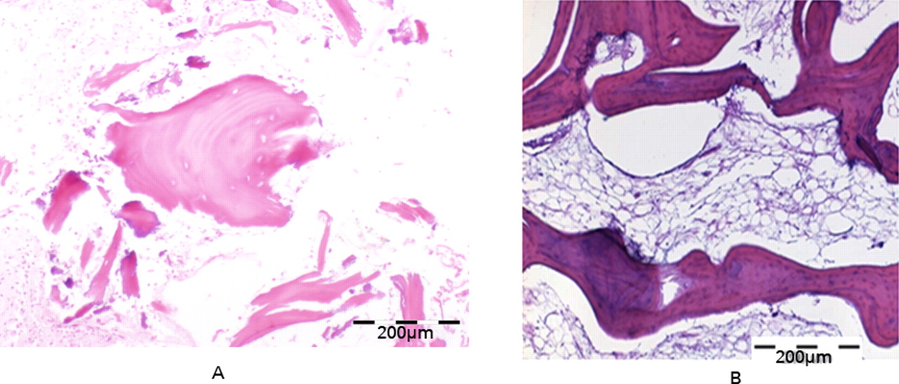 Fig. 3 
          Micrographs of a) the generated tissue
after two weeks of culture, showing more organised bone-like areas,
similar in appearance to b) a sample of a normal human bone (both
haematoxylin and eosin staining).
        