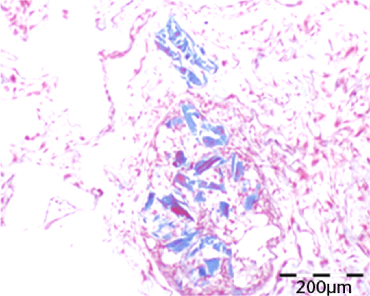 Fig. 4 
          Micrograph of the generated tissue after
two weeks of culture (trichrome staining). Generated collagen is
evident (blue colour).
        