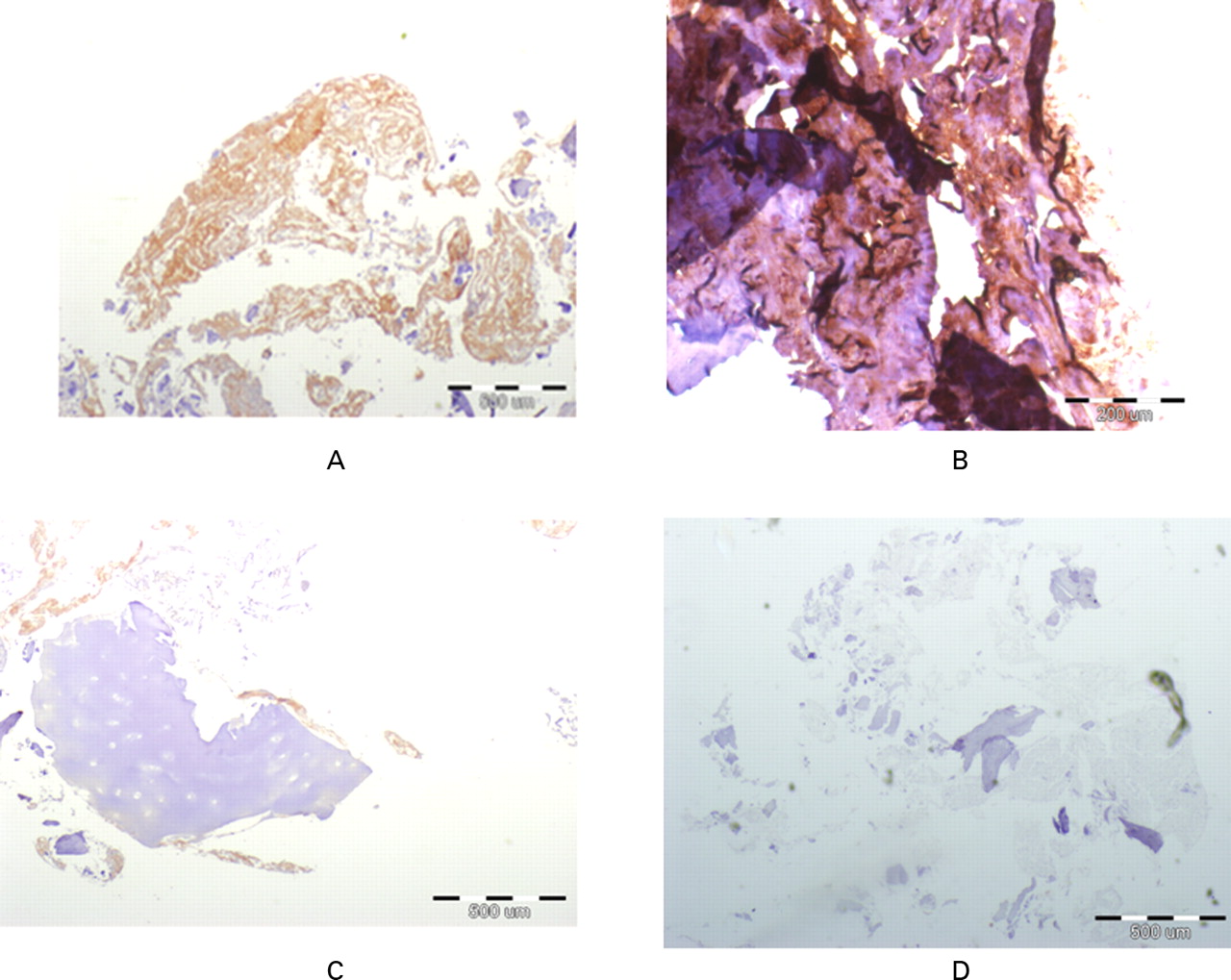 Fig. 5 
          Micrographs showing immunohistochemical stainings
for collagen 1 (brown colour) in a) experimentally generated tissue, b)
normal cancellous bone (positive control), c) cartilage (stained
negative control) and d) experimentally generated tissue without antibody
staining (not stained negative control). Similar positive staining
is evident in the generated tissue and in normal bone sample. Negative
controls show no staining to collagen 1.
        