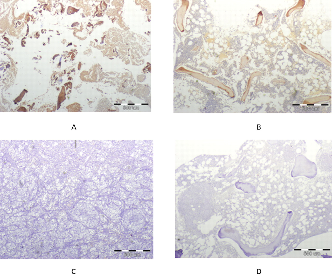 Fig. 6 
          Micrographs showing immunohistochemical staining
for osteocalcin (brown colour) in a) experimentally generated tissue, b)
normal cancellous bone (positive control), c) kidney (negative control)
and d) normal cancellous bone without antibody staining (not stained
negative control). Similar positive staining is evident in the generated
tissue and in normal bone sample. Negative controls show no staining
to osteocalcin.
        