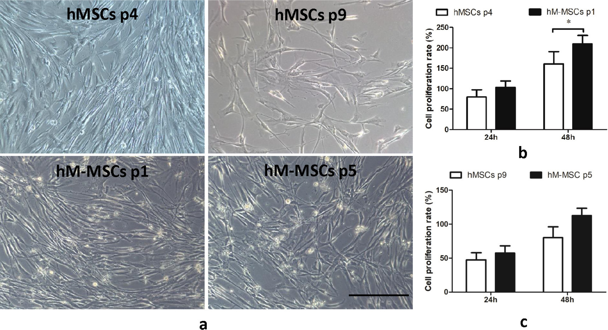 Fig. 1 
            Cell morphology and proliferation of manipulated human mesenchymal stem cells (hM-MSCs) and their untreated human mesenchymal stem cells (hMSCs) controls. a) Cell morphology of hM-MSCs (passage 1 or 5) and their untreated hMSCs controls (passage 4 or passage 9). b) Cell proliferation rate of hM-MSCs at passage 1 (p1) and their untreated hMSCs controls (hMSCs p4) measured at 24 hours or 48 hours after culture by Bromodeoxyuridine / 5-bromo-2'-deoxyuridine (BrdU) assay. c) Cell proliferation of hM-MSCs at passage 5 (p5) and their untreated hMSCs controls (hMSCs p9) measured at 24 hours or 48 hours after culture by BrdU assay. The representative images shown were derived from the bone marrow of donor 1. The data are expressed as mean and SD (n = 2 donors with three replicates for each donor). *p < 0.05 versus human mesenchymal stem cells (MSCs) controls. Scale bar: 50 μm.
          