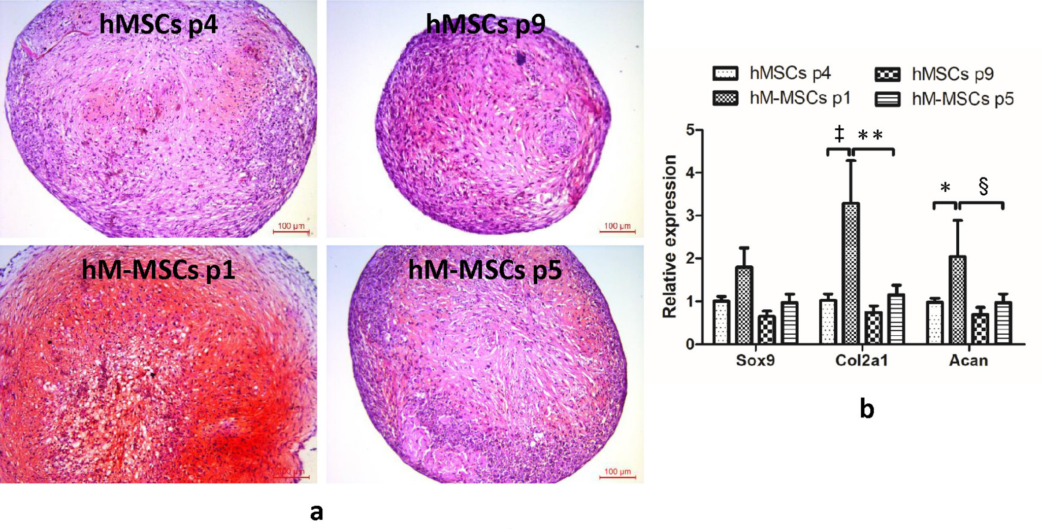 Fig. 2 
            Chondrogenic differentiation capacity of manipulated human mesenchymal stem cells (hM-MSCs) (passage 1 or 5) and their untreated human mesenchymal stem cells (hMSCs) controls (passage 4 or passage 9). a) Safranin O staining results of hM-MSCs or untreated hMSCs controls. b) Relative expression of chondrogenic differentiation markers including Sox9, Col2a1, and Aggrecan (Acan) in hM-MSCs or untreated hMSCs controls. The representative images shown were derived from the bone marrow of donor 1. The data are expressed as mean and SD (n = 2 donors with three replicates for each donor). *p < 0.05 , ‡p < 0.001 versus human mesenchymal stem cells (hMSCs) controls. §p < 0.05, **p < 0.001 versus hM-MSCs at passage 1 (hM-MSCs p1).
          
