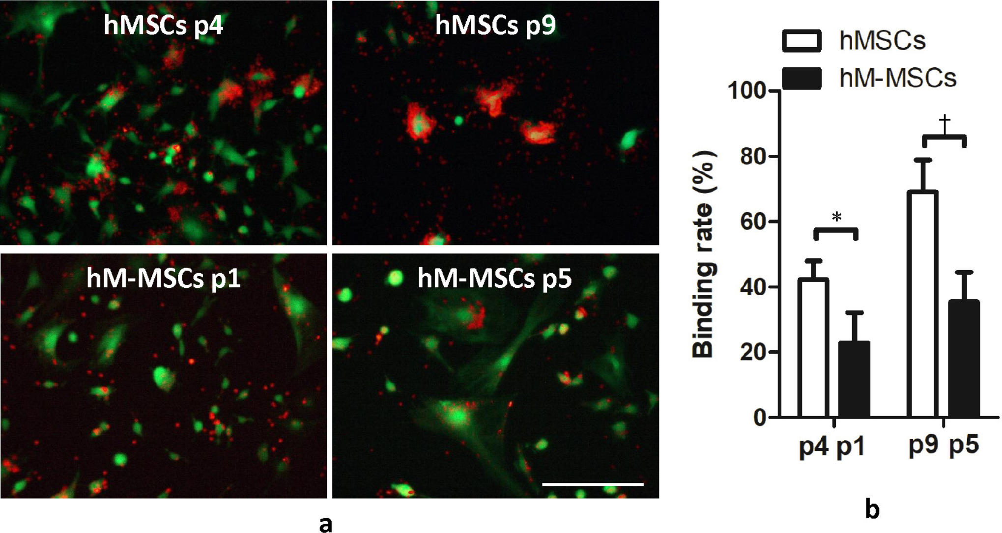 Fig. 3 
            Coculture of human peripheral blood lymphocytes (hPBLs) and manipulated human mesenchymal stem cells (hM-MSCs) (passage 1 or 5) or their untreated human mesenchymal stem cells (hMSCs) controls (passage 4 or passage 9) tested by Rosette forming assay. a) PKH26-labelled (red) stained PBLs formed rosette rings around PKH67-labelled (green) stained hM-MSCs. b) PBL binding rate of hMSC controls or hM-MSCs. Binding rate was calculated as hPBLs binding hMSCs or hM-MSCs (> ten hPBLs binding to one hMSC or hM-MSC) to the total number of hMSCs or hM-MSCs in five random spots. The representative images shown were derived from the bone marrow of donor 1. The data are expressed as mean and SD (n = 2 donors with three replicates from each donor). *p < 0.05, †p < 0.01 versus human mesenchymal stem cells (hMSCs) controls. Scale bar: 50 μm.
          