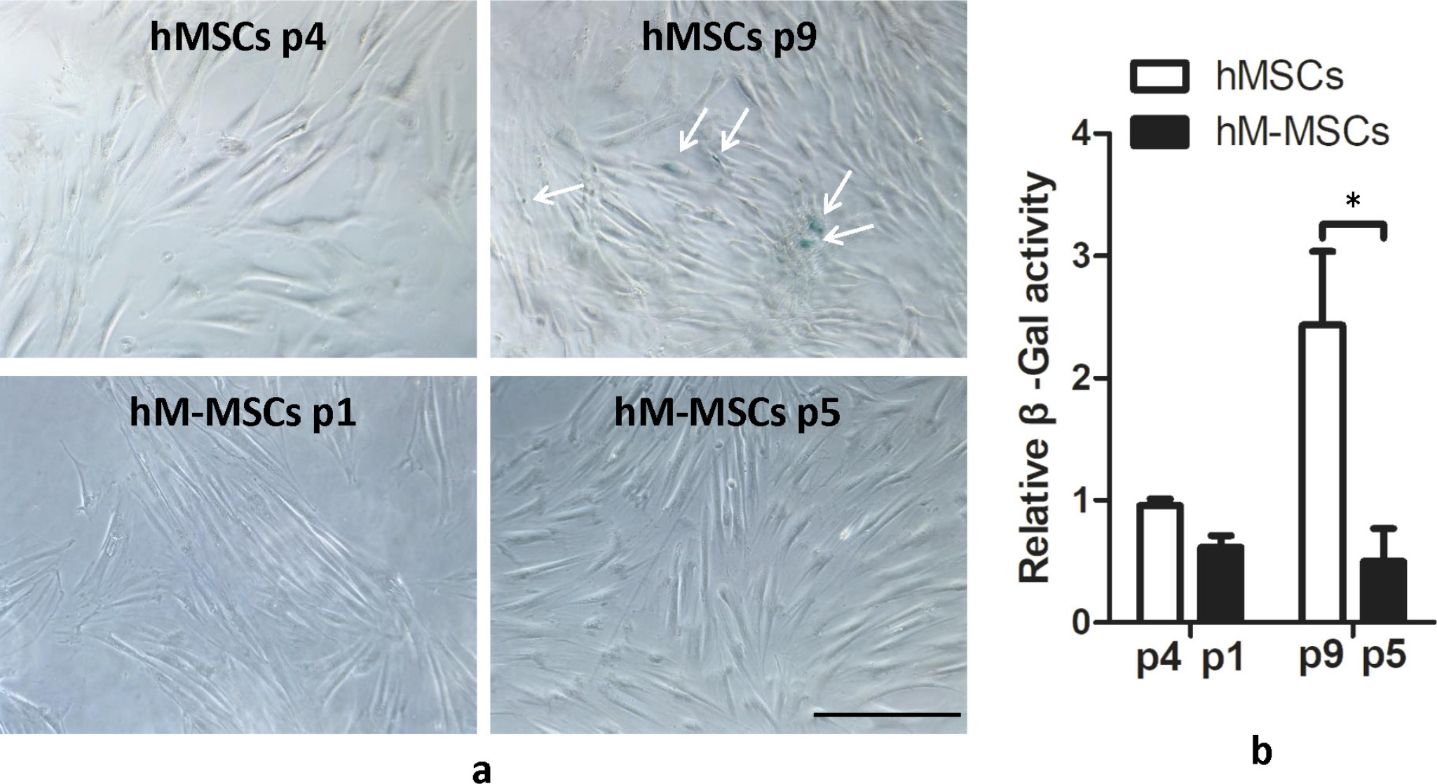 Fig. 4 
            Senescence-associated beta-galactosidase (SA‐β‐gal) activity in manipulated human mesenchymal stem cells (hM-MSCs) (passage 1 or 5) or their untreated human mesenchymal stem cells (hMSCs) controls (passage 4 or passage 9). a) Results of SA‐β‐gal staining examined by bright field microscopy. White arrows point to the β‐gal positive-stained cells. b) Quantitative results of SA‐β‐gal activity in cell lysis. The representative images shown were derived from the bone marrow of donor 1. The data are expressed as mean and SD (n = 2 donors with three replicates from each donor). *p < 0.01 versus hMSCs controls. Scale bar: 50 μm.
          