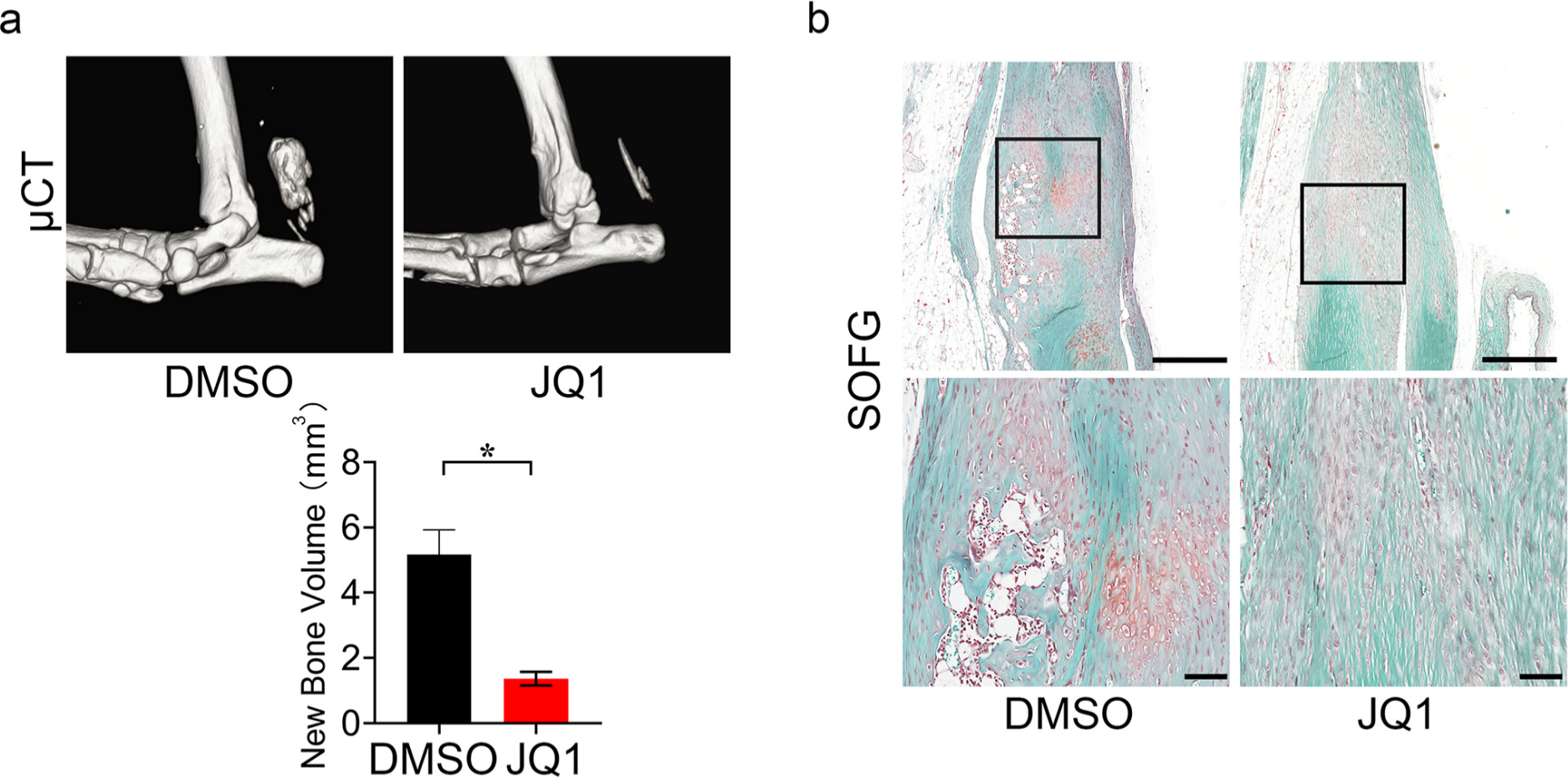 Fig. 4 
            JQ1 attenuates heterotopic ossification (HO) in vivo. a) Micro-CT (μCT) analysis and quantification of new bone in HO model treated with dimethyl sulfoxide (DMSO) or JQ1, n = 10. b) Safranin O Fast Green (SOFG) staining of HO model treated with DMSO or JQ1. Scale bar = 200 μm (upper panel), scale bar = 80 μm (zoom in image on the lower panel).
          