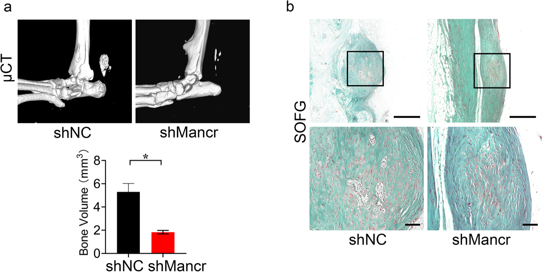 Fig. 5 
            shMancr suppresses the new formation in vivo. a) Micro-CT (μCT) analysis and quantification of new bone in heterotopic ossification (HO) model treated with shNC or shMancr, n = 10. b) Safranin O Fast Green (SOFG) staining of HO model treated with shNC or shMancr. Scale bar = 200 μm (upper panel), scale bar = 80 μm (lower panel). Mancr, mitotically associated long non-coding RNA.
          