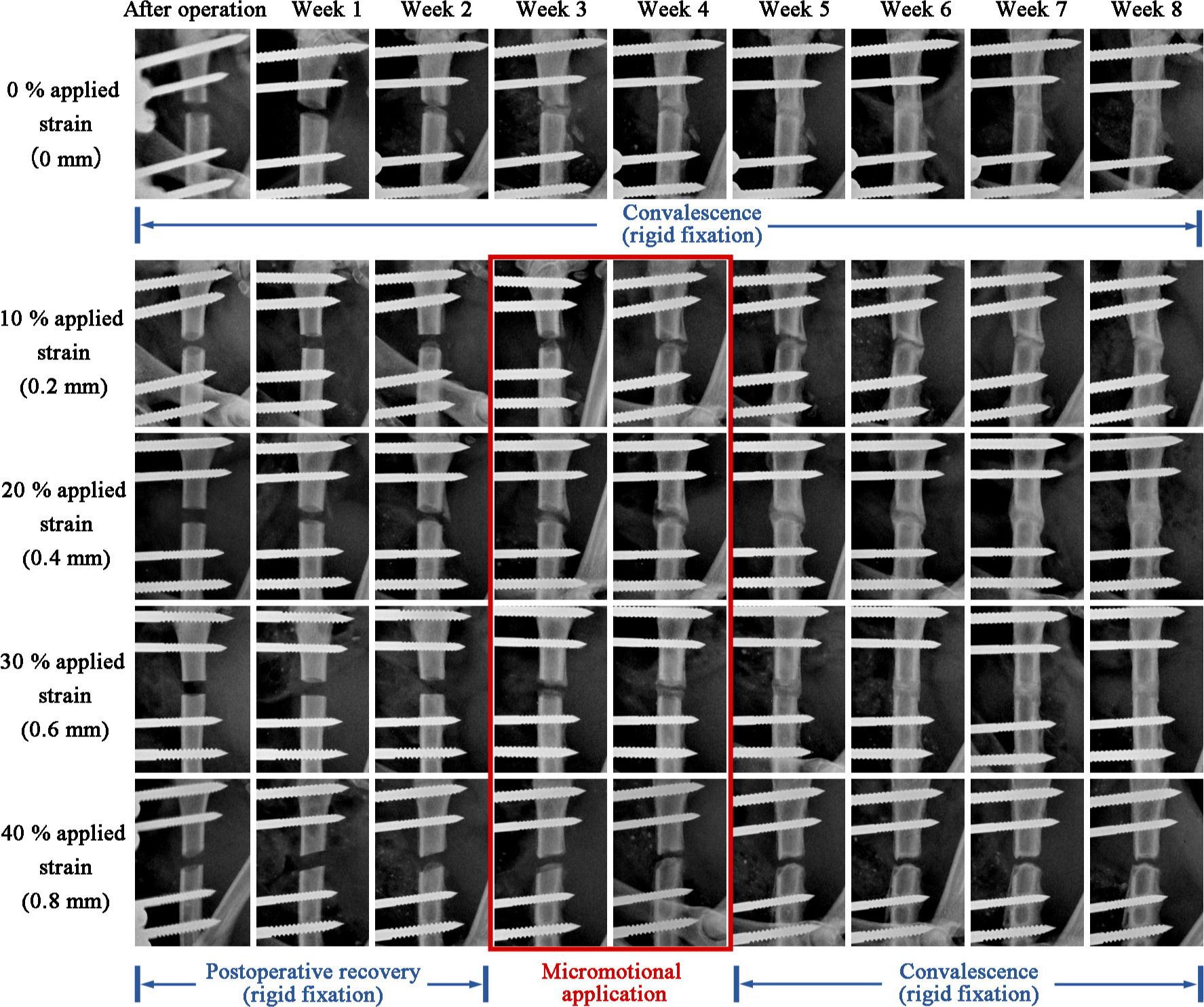 Fig. 6 
          Postoperative lateral radiographs of the five groups (0 to 40% applied strain) obtained immediately and then at weekly intervals for eight weeks to observe periosteal callus formation. The sizes of the formed calluses were much larger in the 10% and 20% applied strain groups than in the 0% and 30% applied strain groups. A nonunion can be observed in the 40% applied strain group.
        