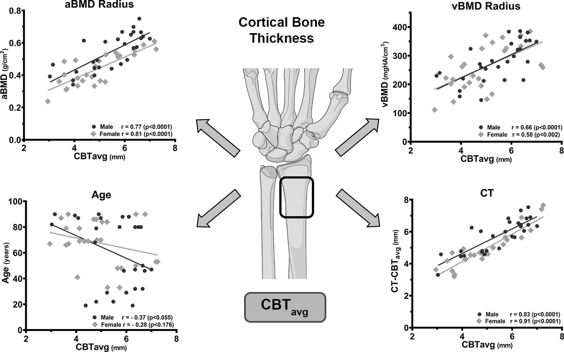 Fig. 6 
            Correlation of the mean average cortical bone thickness (CBTavg) with areal bone mineral density (aBMD), volumetric BMD (vBMD), age, and CT measurement. The high correlation of CBTavg with aBMD and vBMD enables prediction of the radial BMD if quantitative measurements are unavailable. In contrast, age is a weak predictor for CBTavg and has no predictive value in the age group > 65 years. The high correlation of the CBTavg with the CT measured CT-CBTavg confirms the reliable determination from standard radiographs (illustration provided by AO Surgery Reference25). All p-values calculated using two-tailed Pearson correlation coefficient.
          